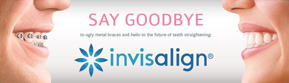 Invisalign for Teens and Adults Orlando Florida